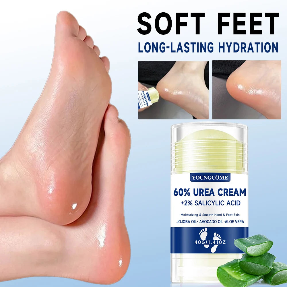 YOUNGCOME 60% Urea Foot Cream 2-Pack – Deep Moisturiser Urea Foot Cream Qst