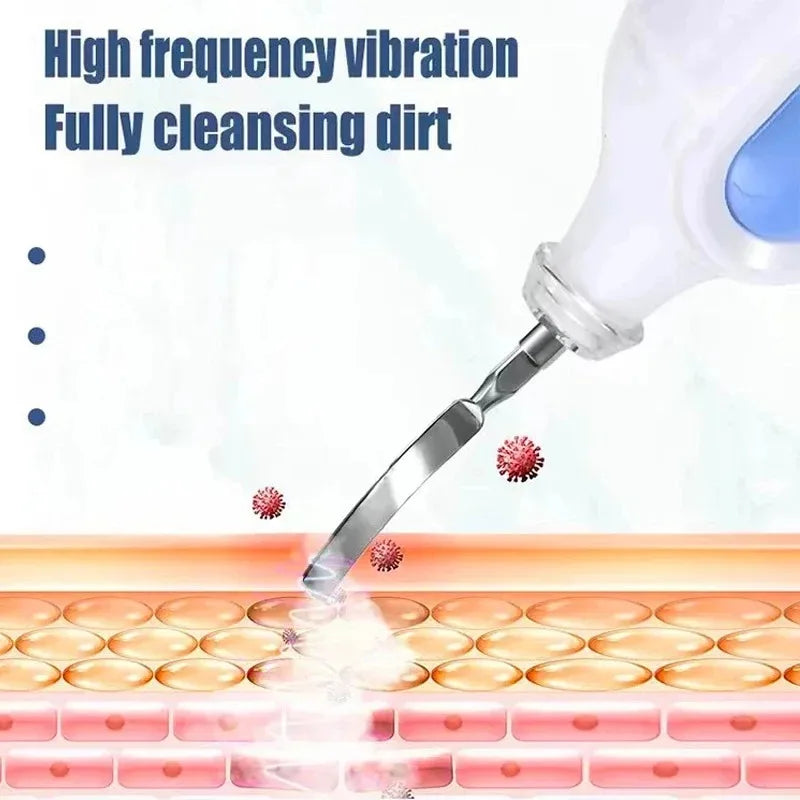 Ultrasonic Skin Scrubber Spatula – Portable Pore Cleansing Tool Facial Cleansing Device Qst
