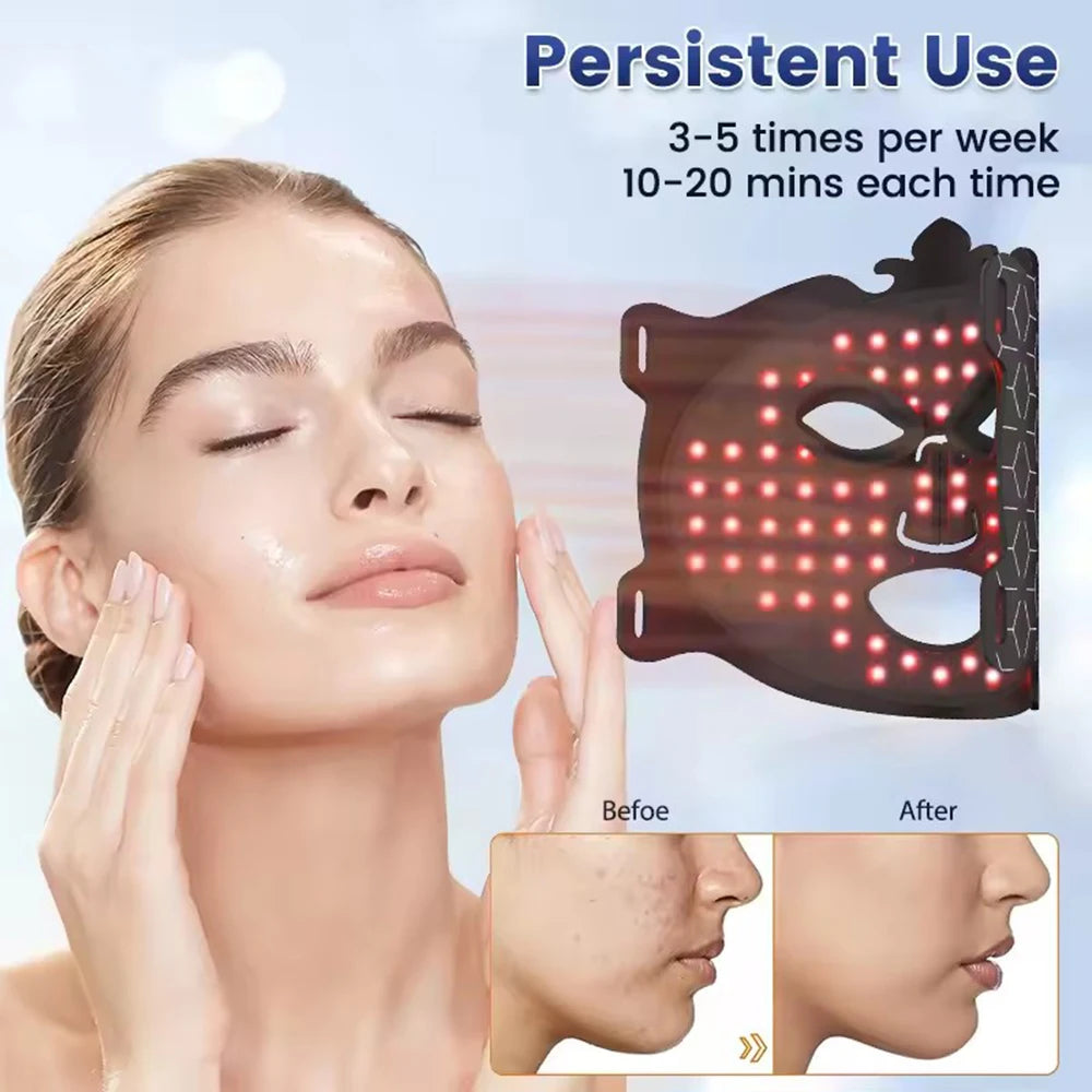 8-Color Silicone LED Face Mask | Red Light Photon Therapy LED Therapy Mask Qst