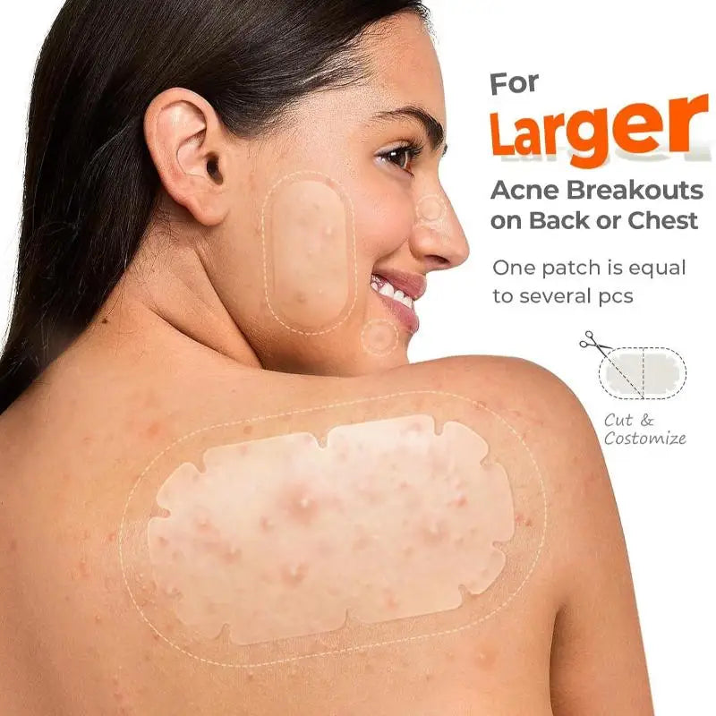 Hydrocolloid Acne Patches – Multi-Shape Invisible Bulk Pack Hydrocolloid Acne Patches Qme