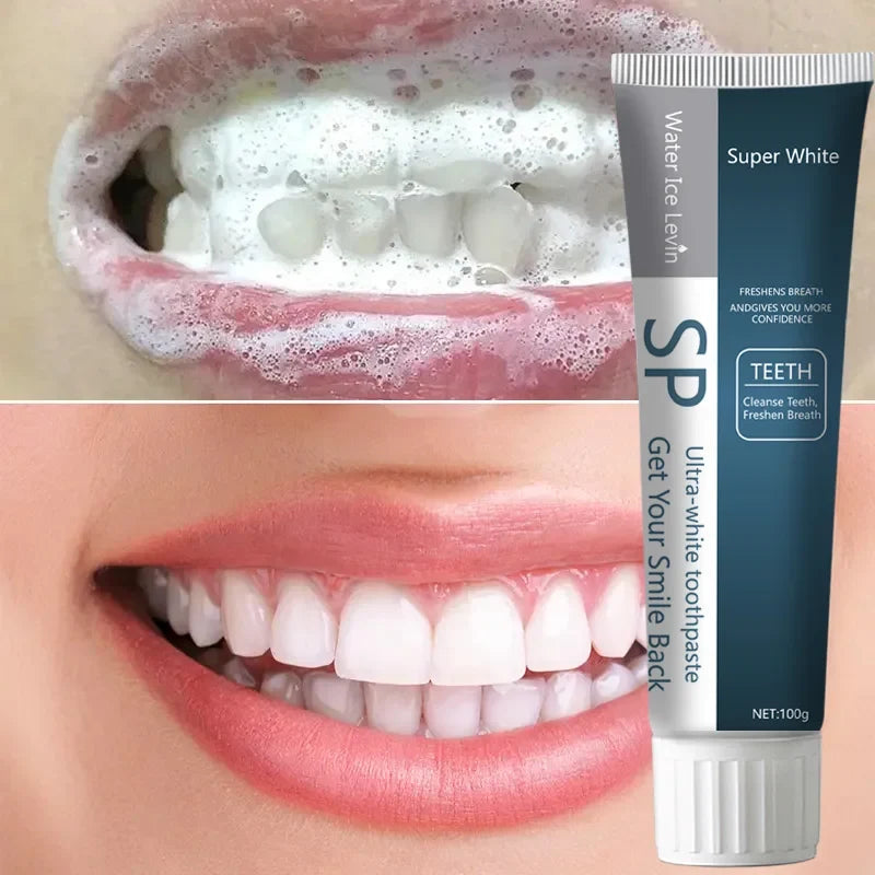 SP Probiotic Whitening Toothpaste – Fresh Breath & Stain Removal Whitening Toothpaste Qme
