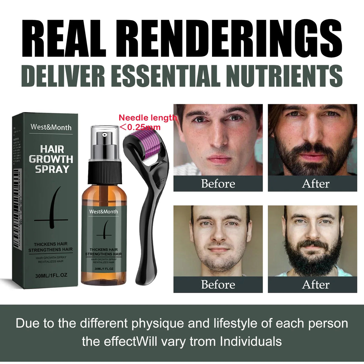 Men's Beard Spray & Micro Roller Moisturizing Thickening Kit Beard Care Kit Qme