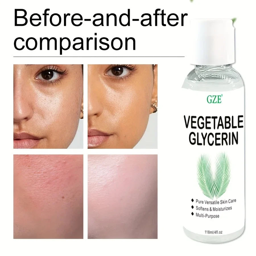 GZE 100% Pure Vegetable Glycerin – Skin Softener & Moisturizer Skin Care Glycerin Qme