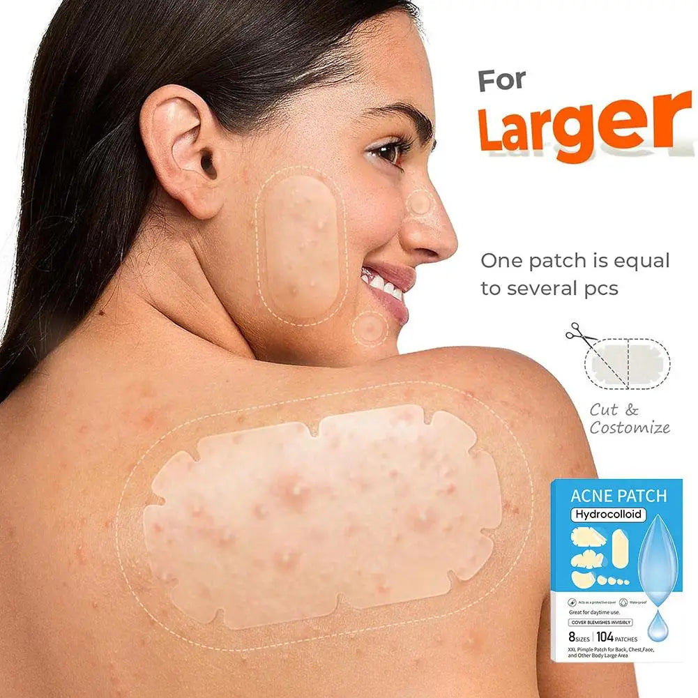 Hydrocolloid Pimple Patches Bulk – 5 Sizes for Face & Body Acne Pimple Patches Qme