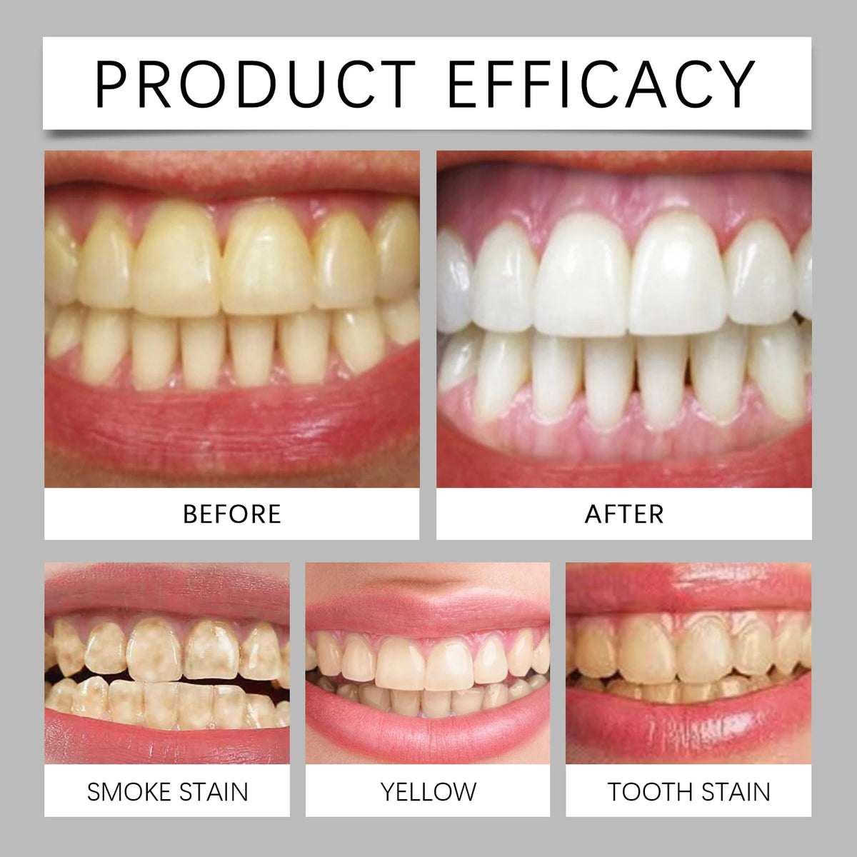 Natural Teeth Brightening Powder – Gentle Stain Removal 50g Teeth Brightening Powder Qst