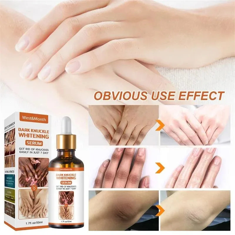 Skin Brightening Essence – Knuckle, Elbow & Knee Serum 50ml Brightening Body Serum Qst
