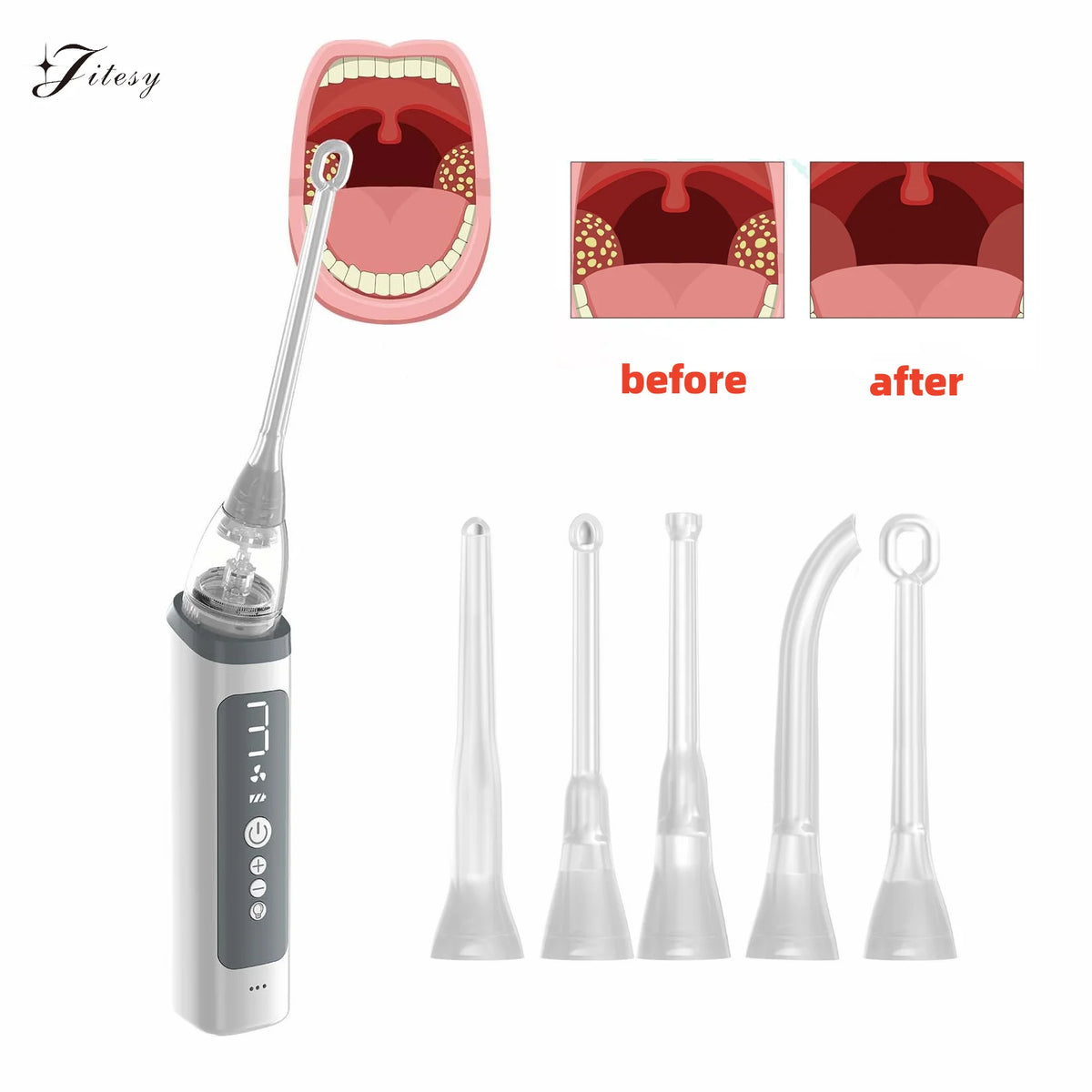 Electric Tonsil Stone Remover – LED, 8 Suction Modes, Oral Kit Oral Care Device Qst