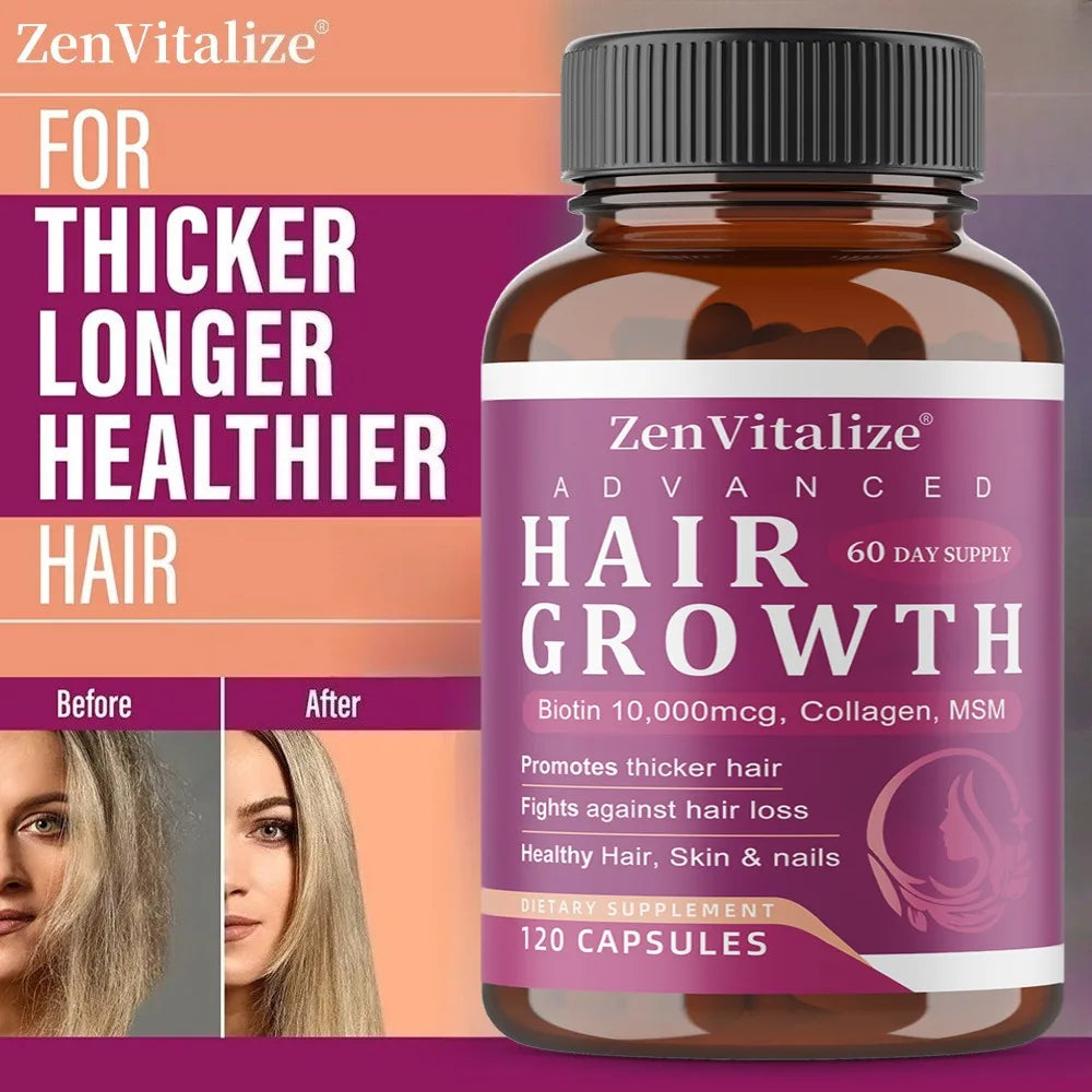 ZENVITALIZE Biotin & Collagen Hair Growth Supplements – Unisex Hair Growth Supplement Qst