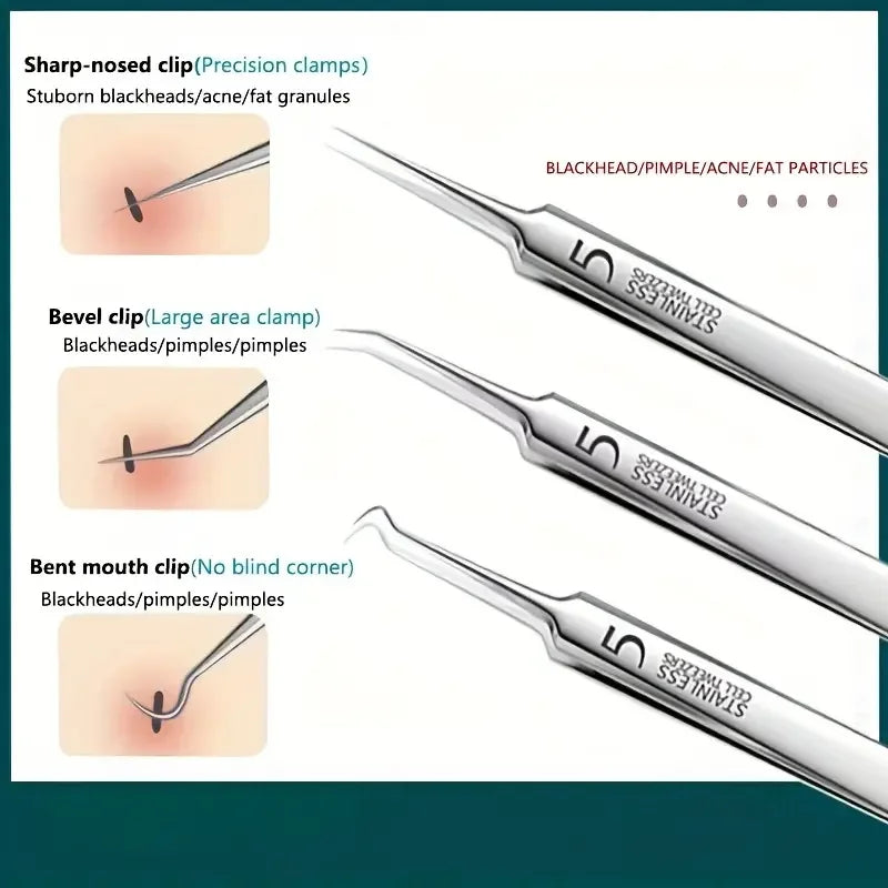 Stainless Steel Blackhead & Blemish Extractor Tool | Qme Skincare Extractor Tool Qme