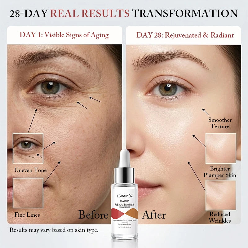 YOUNGCOME Niacinamide Facial Serum – Brightening & Collagen Facial Serum Qst