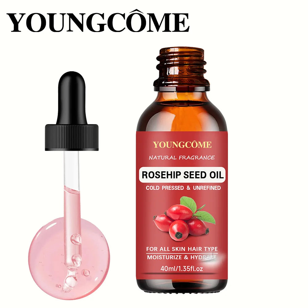 YOUNGCOME Rose Essential Oil – Aromatherapy & Skin Care 40/60ml Essential Oil Qst