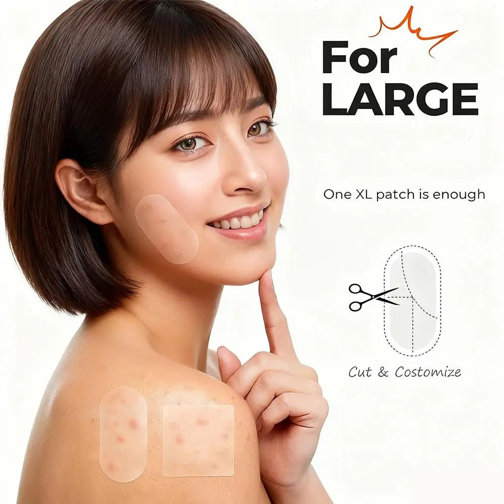 Invisible Acne Patches – Shaped Pimple Cover & Oil Control Acne Patch Qme