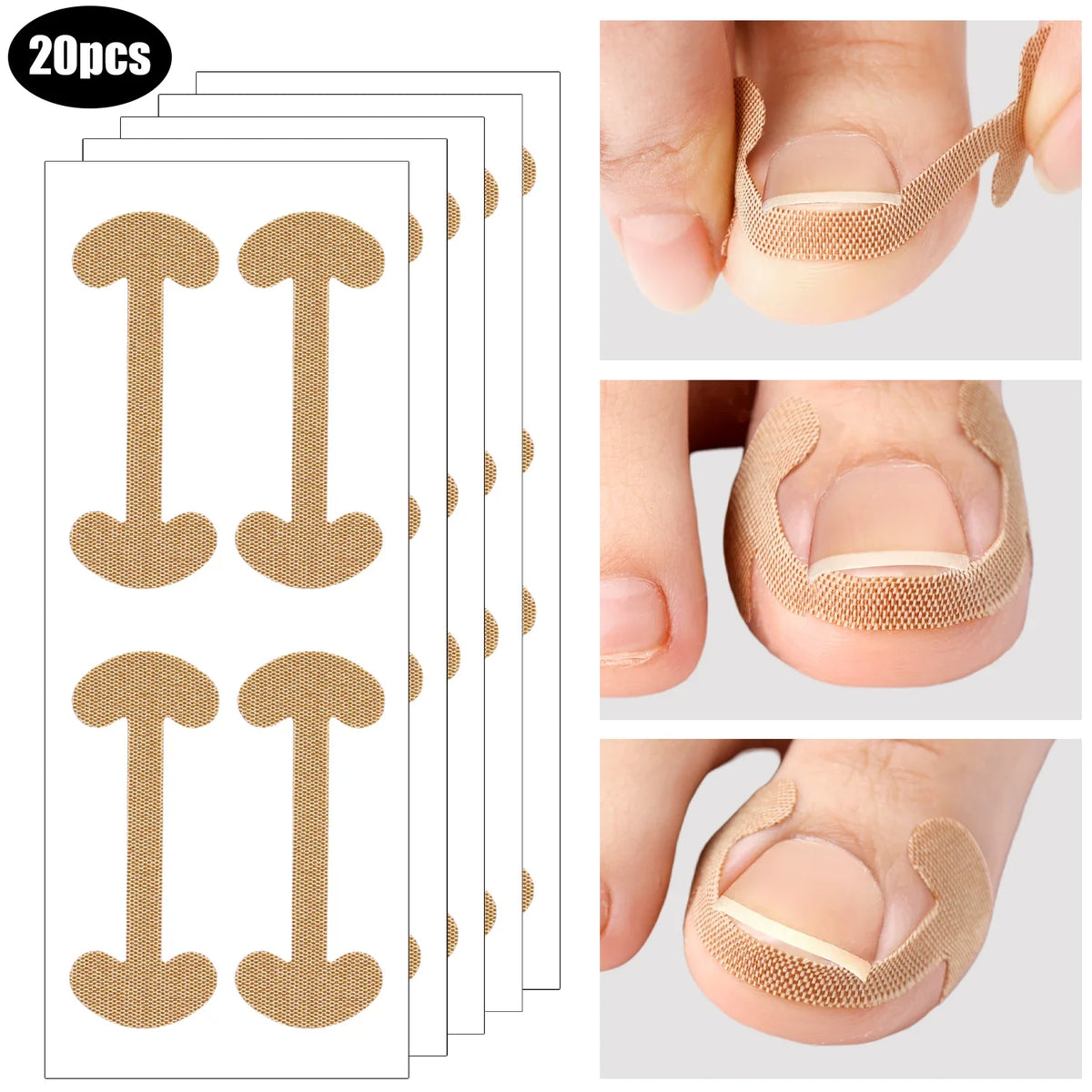 Waterproof Toenail Correction Strips | Lasting Adhesion Nail Correction Strips Qme