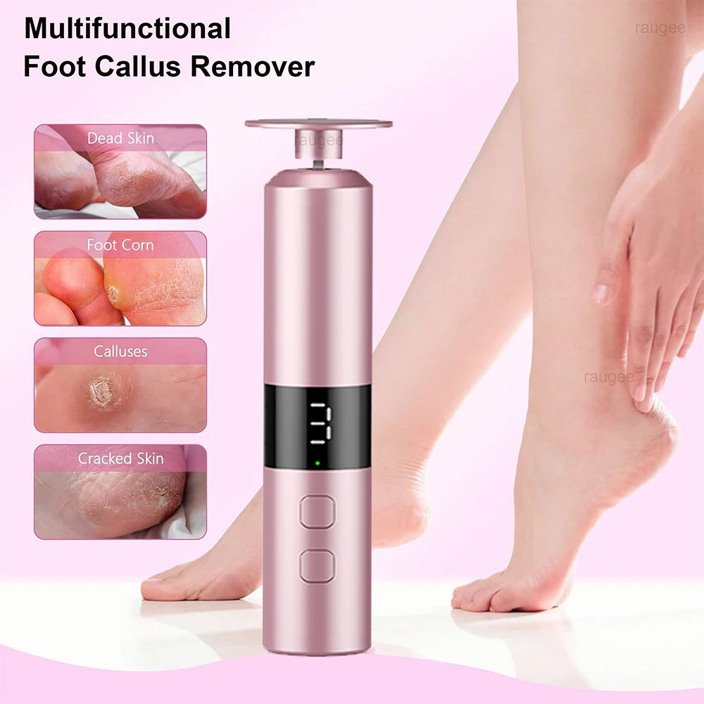 Electric Foot Callus Remover Rechargeable – bcomfy Feet File Electric Callus Remover Qst