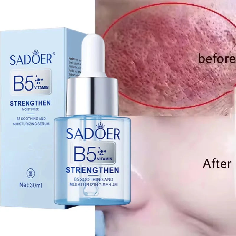 Facial Redness Repair Serum – Sensitive & Dry Skin Serum Facial Serum Qme