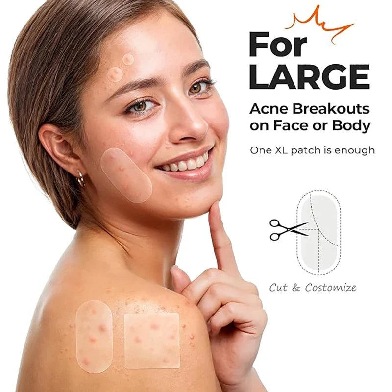 Invisible Blemish Spot Patches – 116 pcs Concealing & Repair Blemish Spot Patches Qme