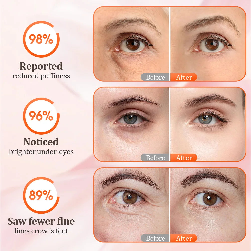 3D Eye Massager – Red Light Therapy & Microcurrent Eye Care Eye Massager Device Qst