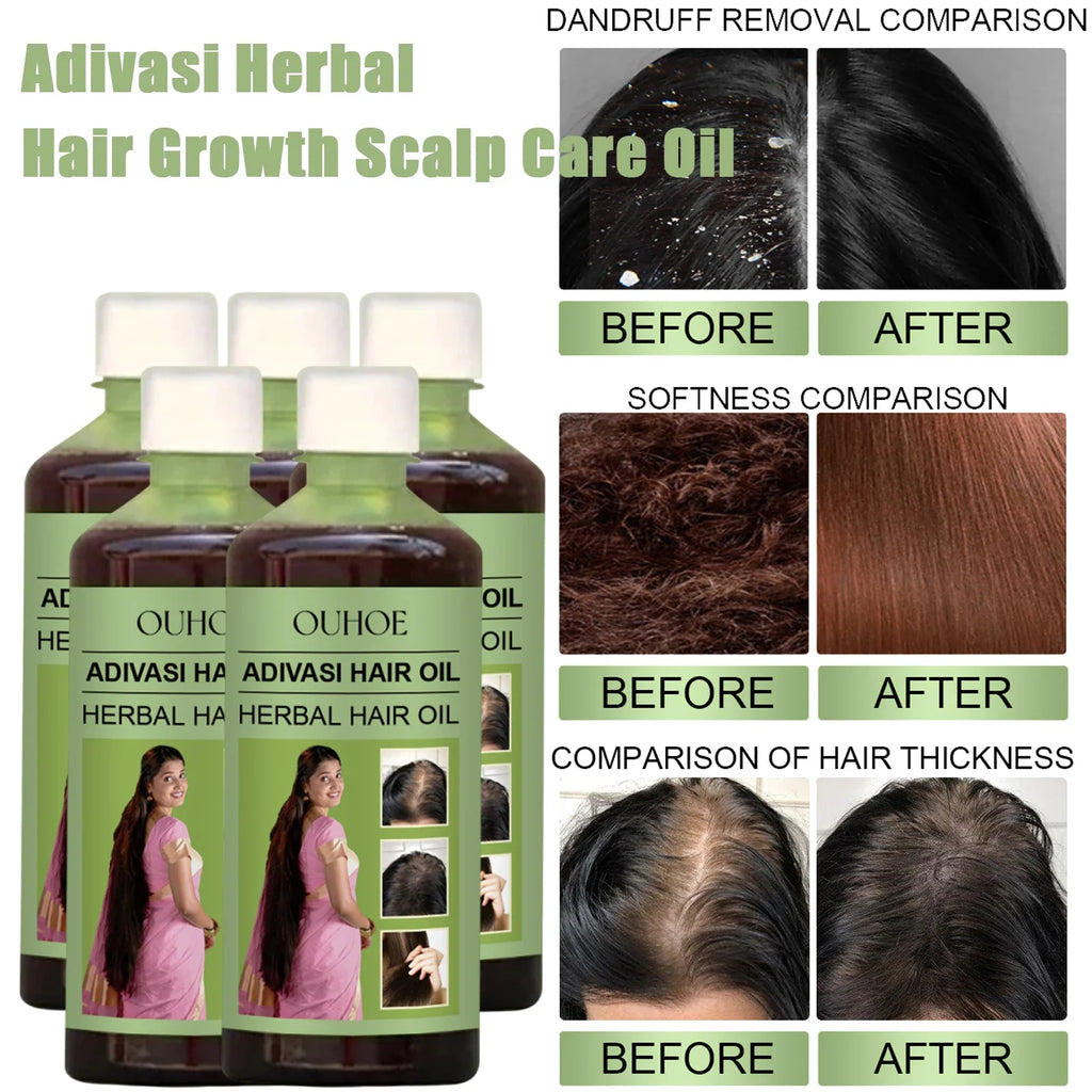 Adivasi Herbal Rosemary Hair Growth Oil – Hydrate & Restore Herbal Hair Growth Oil Qme