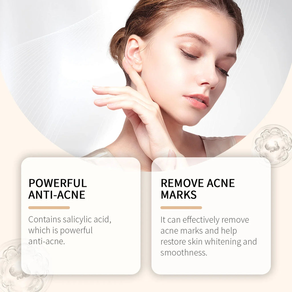 Calendula Blemish Cream – Oil Control, Mark Fading | Qme Facial Moisturizer Cream Qme