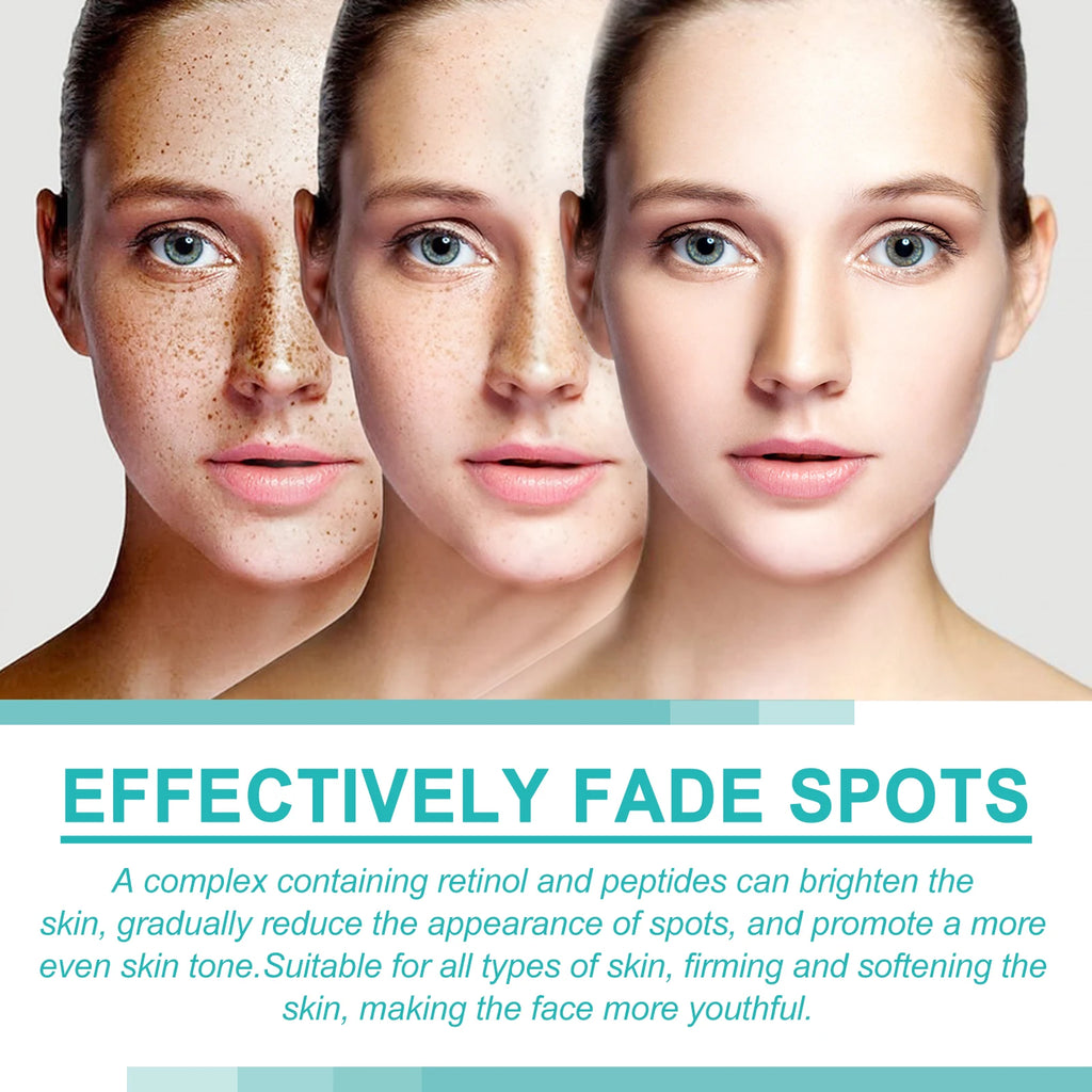 EELHOE Niacinamide Brightening Cream – Fade Dark Spots Brightening Face Cream Qst