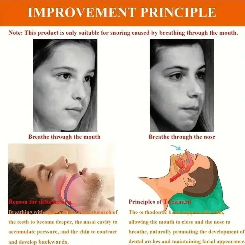 Anti-Snoring Chin Strap – Adjustable Sleep Mouth Support Band Anti-Snoring Chin Strap Qst