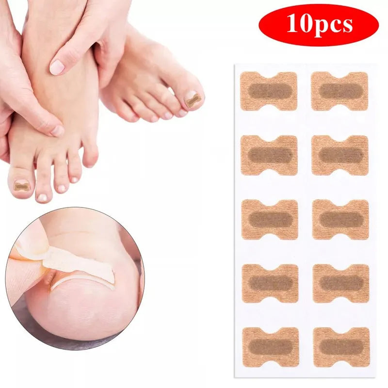 Toenail Correction Strips – Waterproof Pedicure Tool 10/100 Pcs Toenail Correction Strips Qst 1 Sheet (10 PCS)