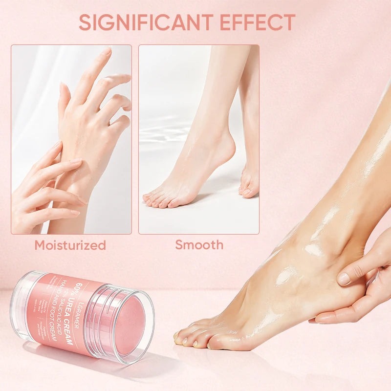 Urea Foot Cream with Salicylic Acid & Hyaluronic Acid – 40g Foot & Hand Cream Qst