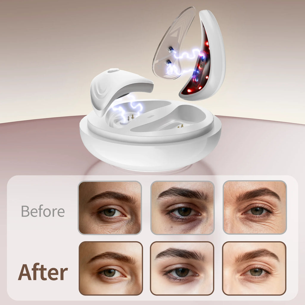 VIMYSHOW Red Light Under Eye Massager – Microcurrent Device Eye Massager Device Qst