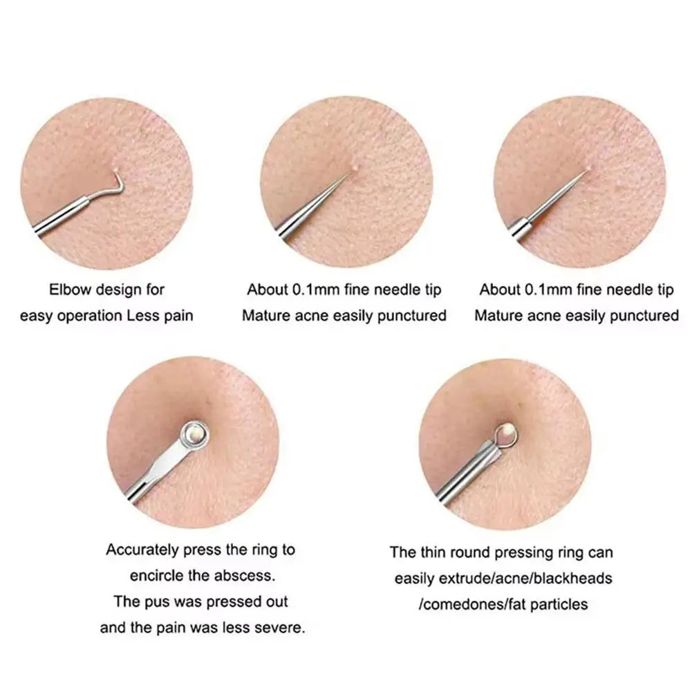 4-Piece Blackhead Remover Tool Set – Curved Tweezers & Needle Blackhead Remover Set Qme