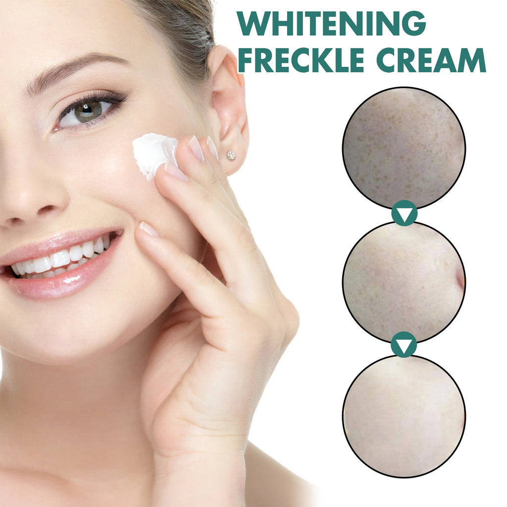 EELHOE Niacinamide Brightening Face Cream – Dark Spot 30g Brightening Face Cream Qst