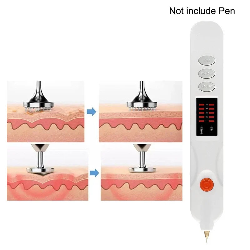 Replacement Plasma Pen Tips for Skin Spot & Blemish Care Plasma Pen Tips Qme