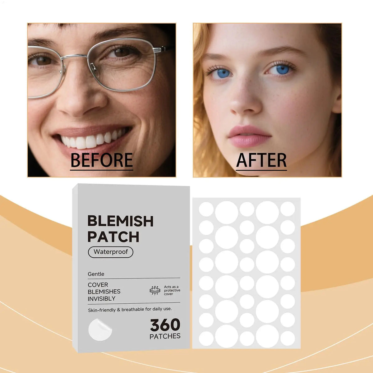 Hydrocolloid Acne Concealer Patches – Waterproof Spot Dots Acne Concealer Patch Qme