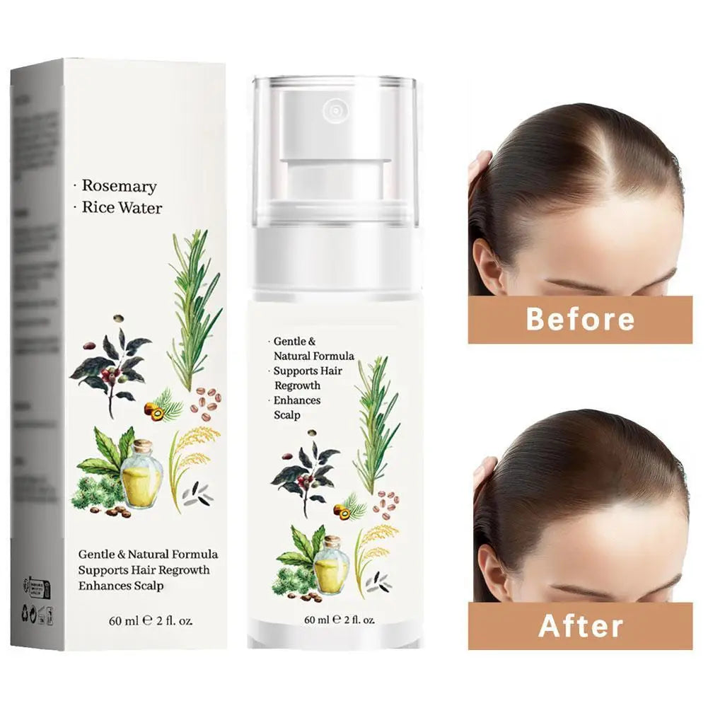 Qme Hair Strengthening Serum – Scalp Nourishing Volume Spray Hair Strengthening Serum Qme 1pcs CN