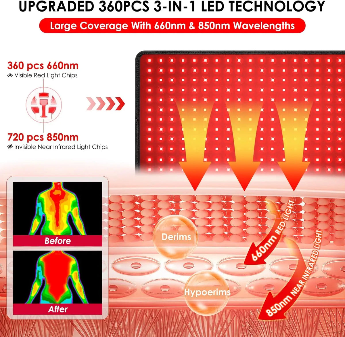 ZONGKUNG 360 LED Red Light Therapy Pad 660nm 850nm Full Body Light Therapy Pad Qst