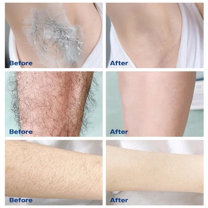 3-Minute Hair Removal Cream with Growth Inhibitor | Face & Lip Hair Removal Cream Qme