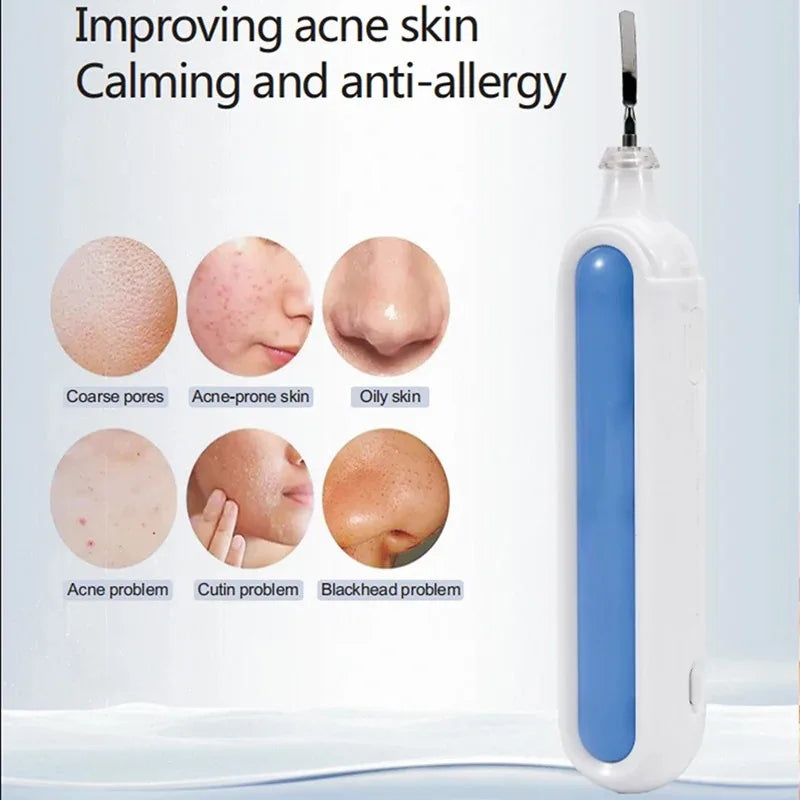 Ultrasonic Skin Scrubber Spatula – Portable Pore Cleansing Tool Facial Cleansing Device Qst