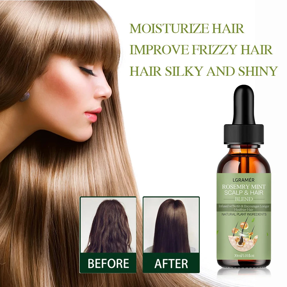 Rosemary Mint Hair Growth Oil – Nourishing & Strengthening Hair Growth Oil Qst