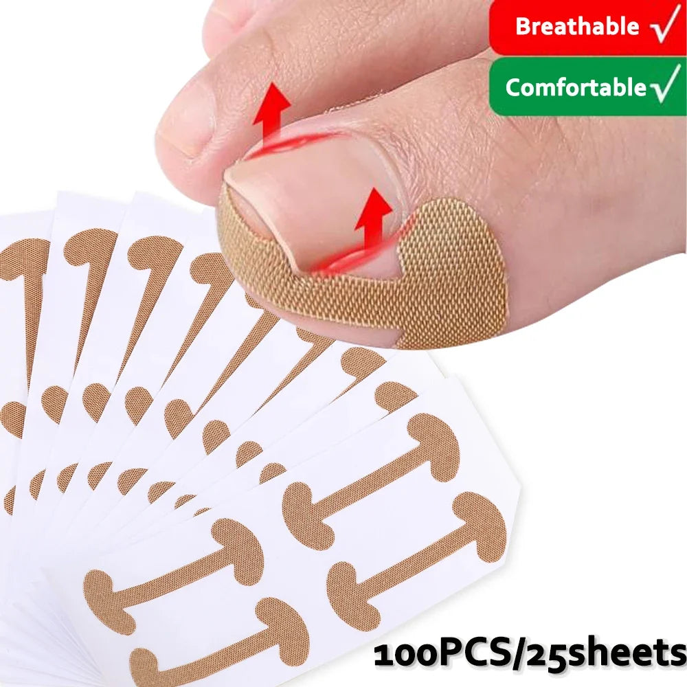 Waterproof Toenail Correction Strips | Lasting Adhesion Nail Correction Strips Qme