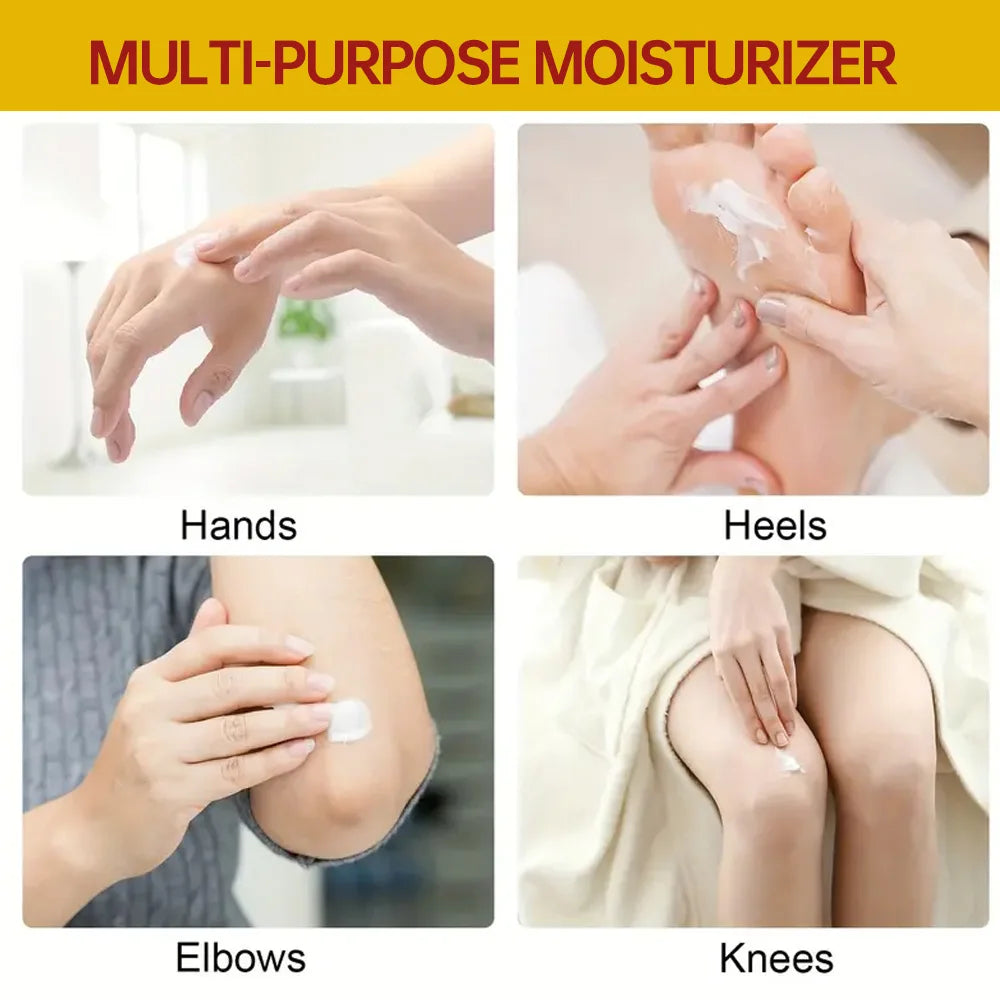 YOUNGCOME Banana Oil Foot Cream – Heel & Hand Moisturizer Foot Cream Qst