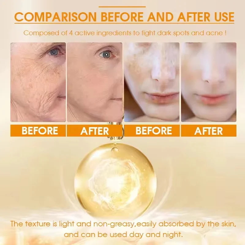 Turmeric Brightening Essence – Dark Spot & Pigmentation Serum Brightening Face Serum Qme
