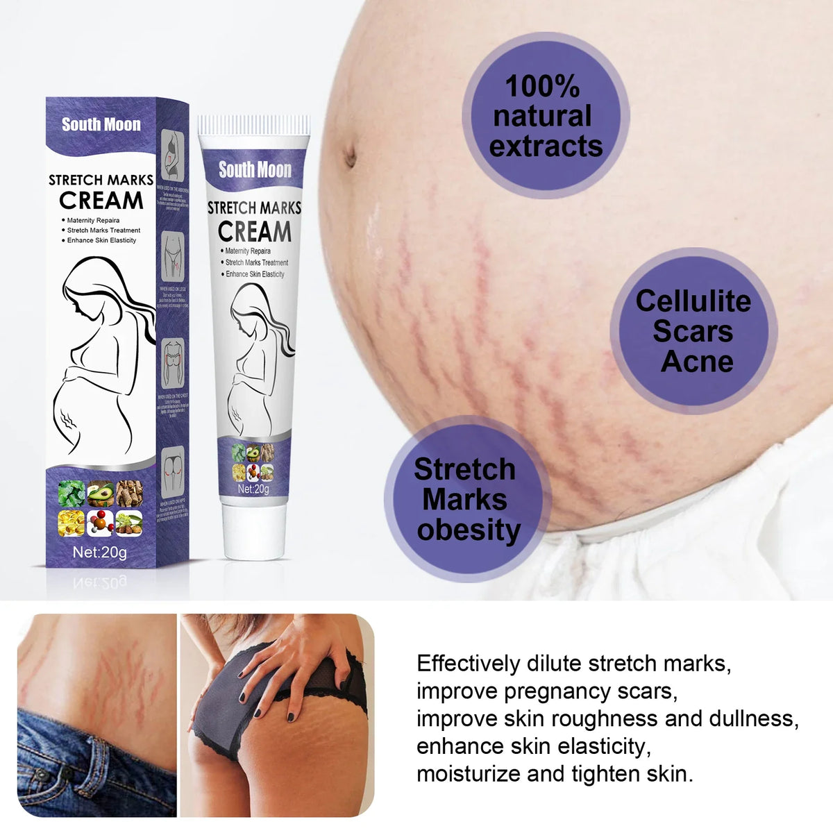 Stretch Mark Cream – Firms, Hydrates & Improves Skin Elasticity Body Firming Cream Qme