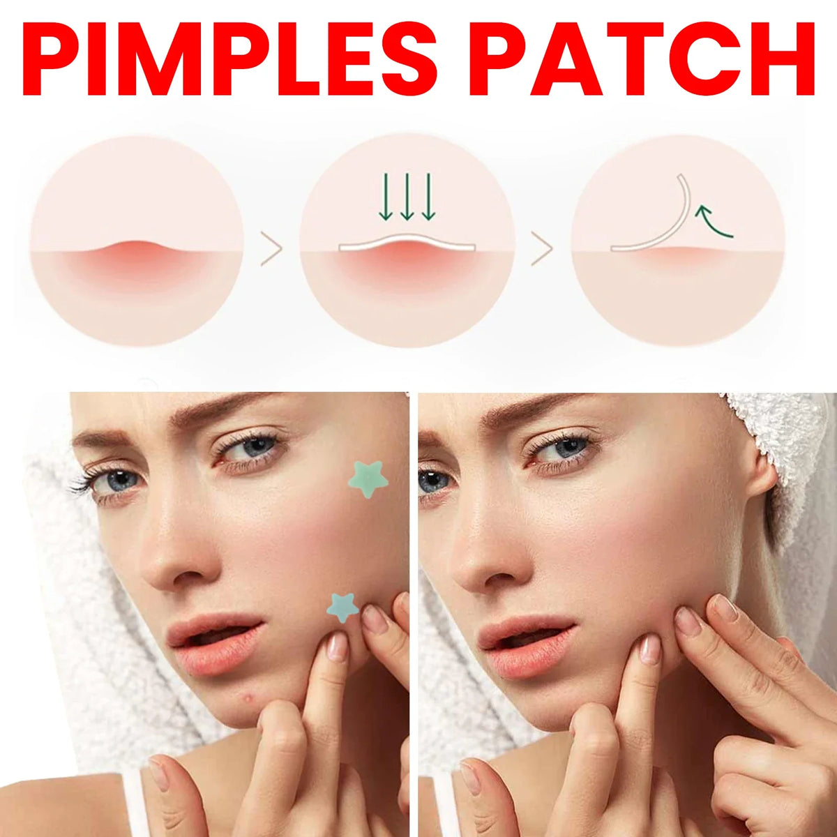 Hydrocolloid Acne Patches Star-Shaped Blemish Cover 200pc | Qme Acne Spot Patches Qme