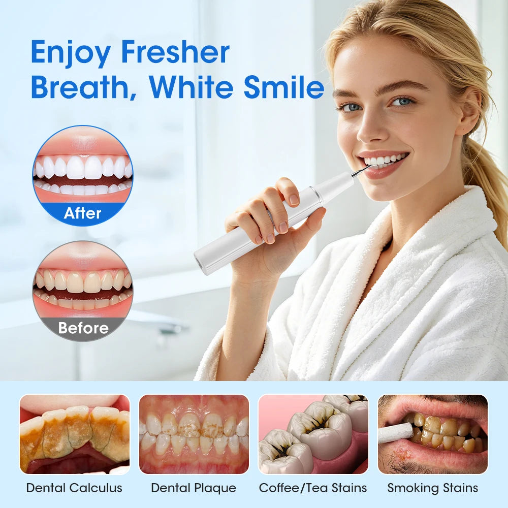 Ultrasonic Dental Scaler – 5-Mode Tartar & Plaque Remover Ultrasonic Dental Scaler Qst