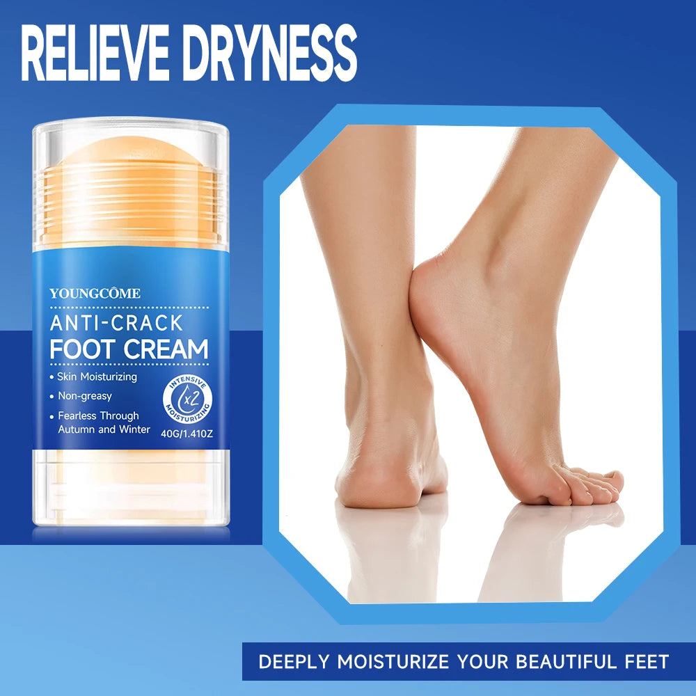 YOUNGCOME Cracked Heel Cream 2-Pack – Moisturizing Foot Ointment Foot Heel Cream Qst