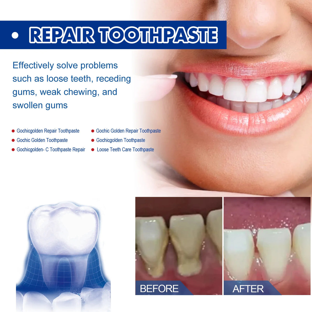 PWYUMAN Probiotic Whitening Toothpaste – 100g Dental Cleanser Whitening Toothpaste Qst
