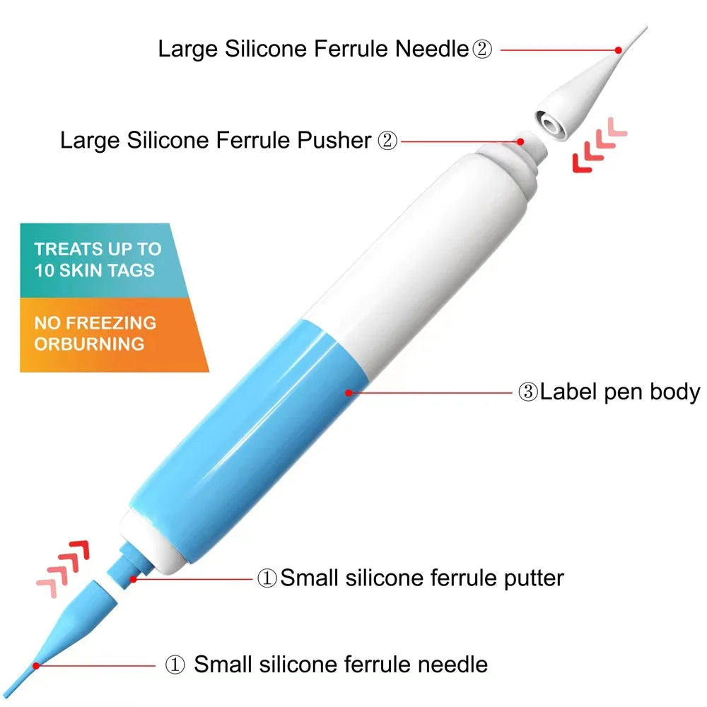 2-in-1 Skin Tag Removal Kit – Band Device for Face & Body Skin Tag Removal Kit Qst