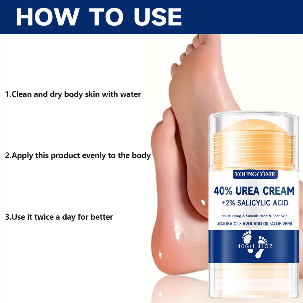 YOUNGCOME 40% Urea Foot Cream + 2% Salicylic Acid Dry Feet Foot Cream Qst
