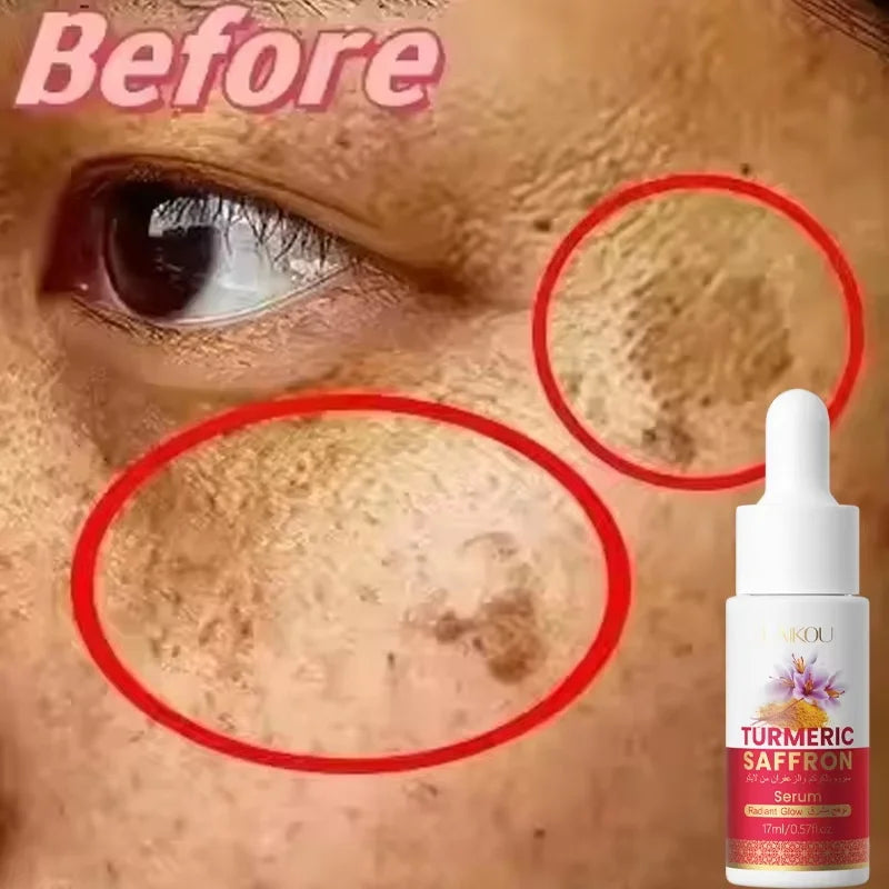 Turmeric Brightening Essence – Dark Spot & Pigmentation Serum Brightening Face Serum Qme