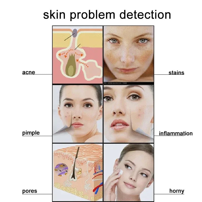 5" Scalp & Skin Analyzer 50X/200X LCD Hair Follicle Detector Scalp & Skin Analyzer Qst
