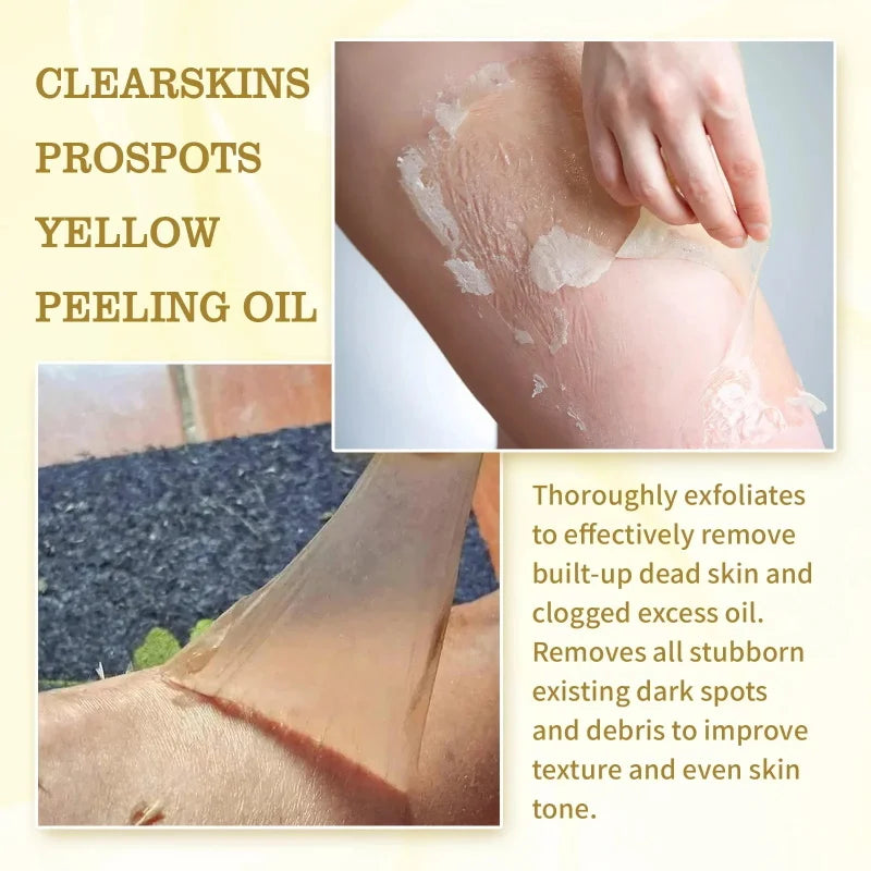 Brightening Peeling Oil Body Lotion – Exfoliate & Even Skin Tone Exfoliating Body Lotion Qme